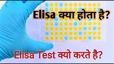 elisa test hindi|what is elisag test.